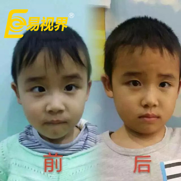 易視界為孩子帶來光明與希望