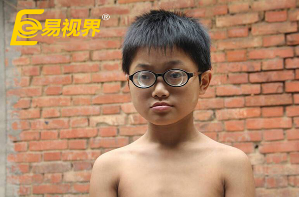 11歲男孩近視2200度 易視界呼吁關(guān)愛(ài)孩子視力