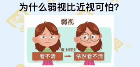 為什么弱視比近視可怕?