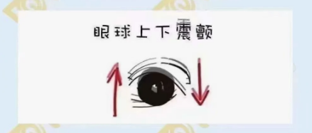 什么是眼球震顫？