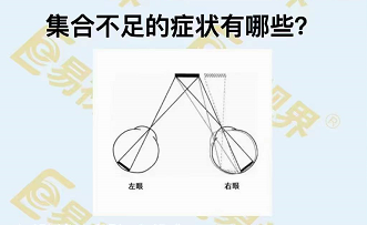 集合不足的癥狀有哪些?